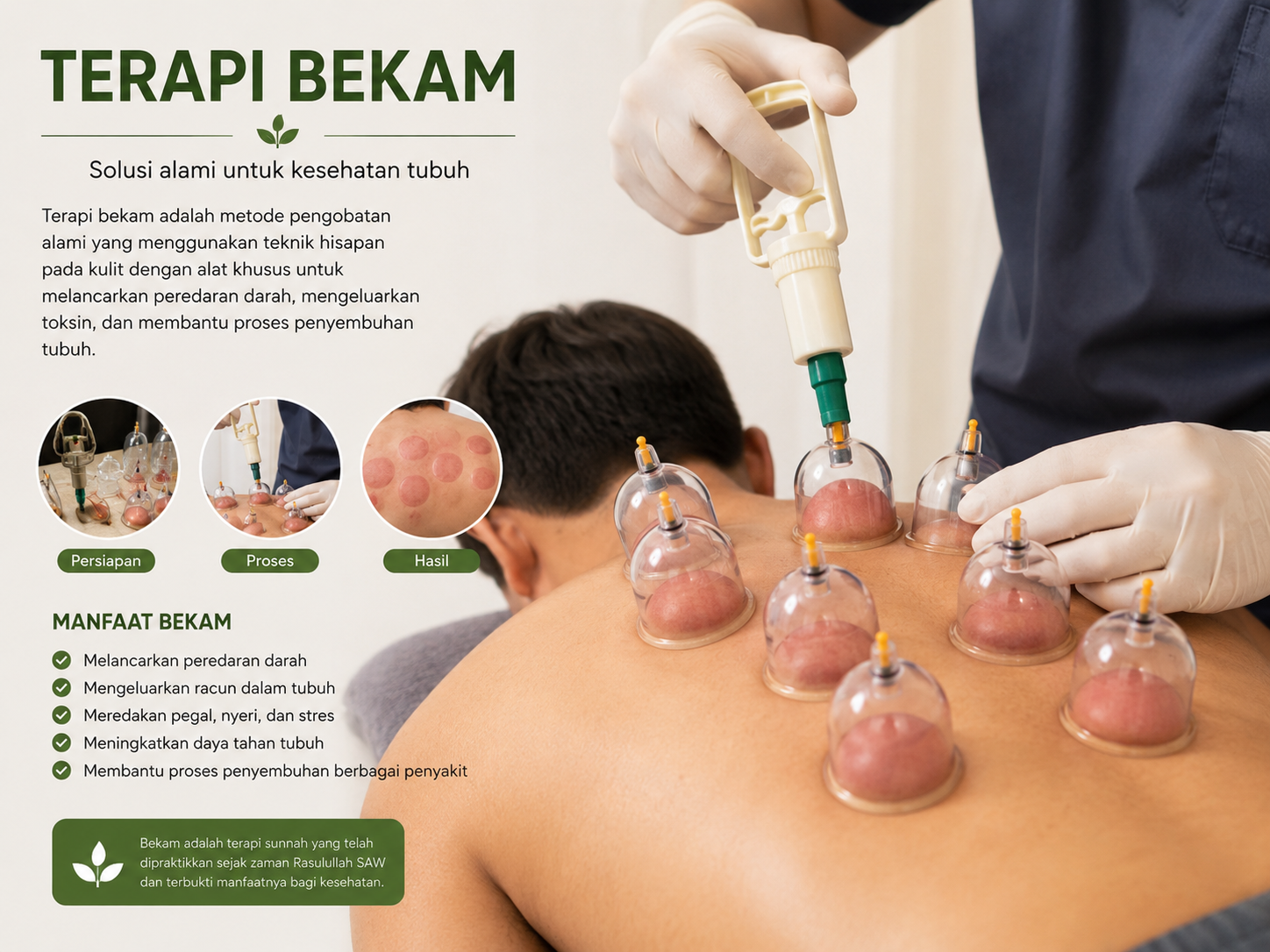 Tenyata Bekam Kuwi Sehat E Nyata Lurr..!